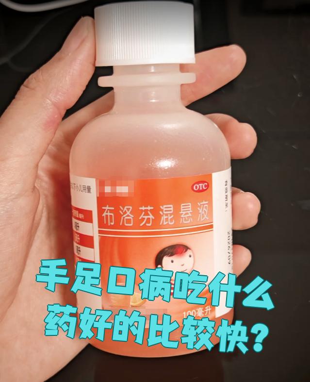 手足口用什么药好