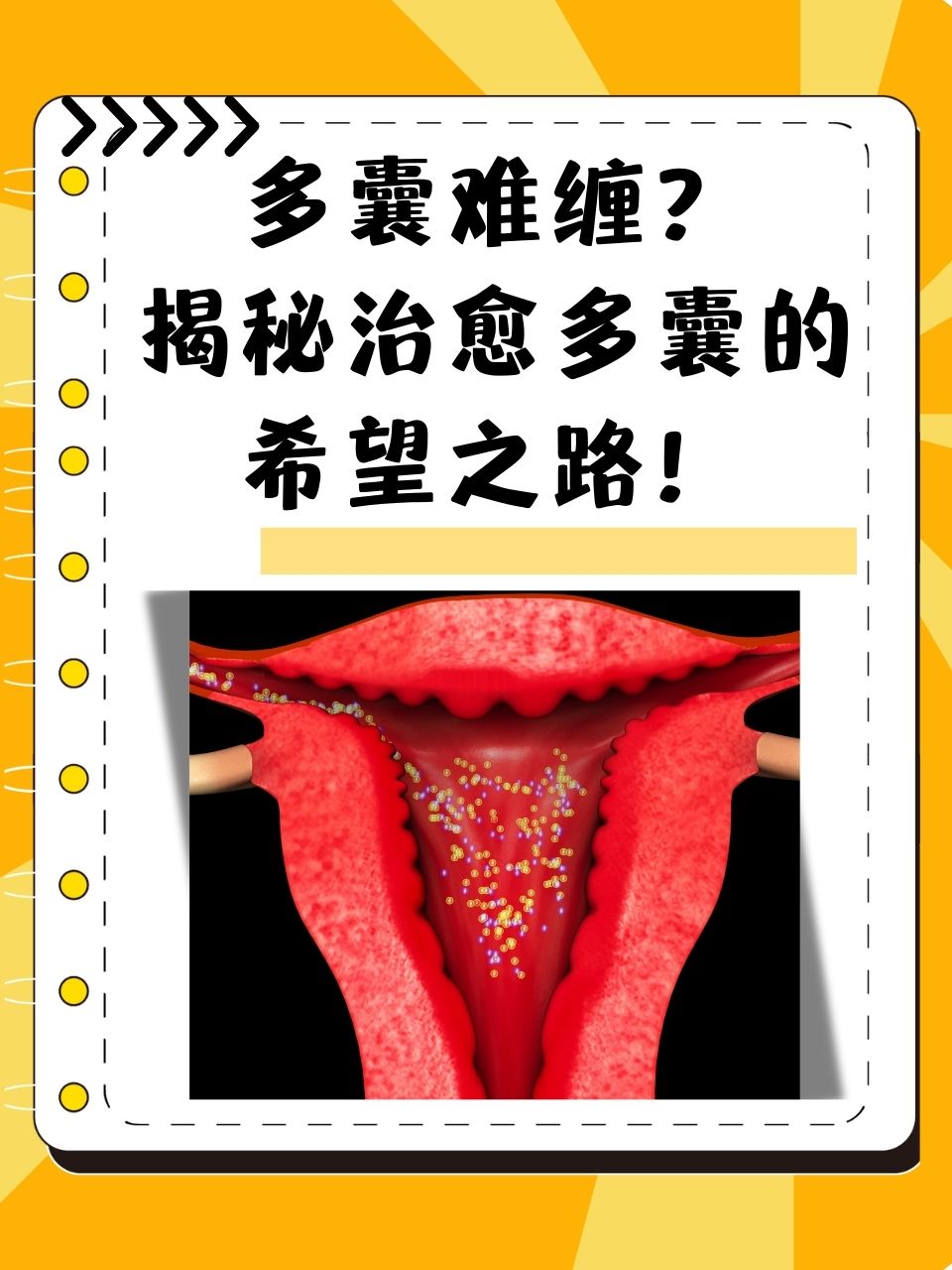 什么是多囊性卵巢?有什么坏处?