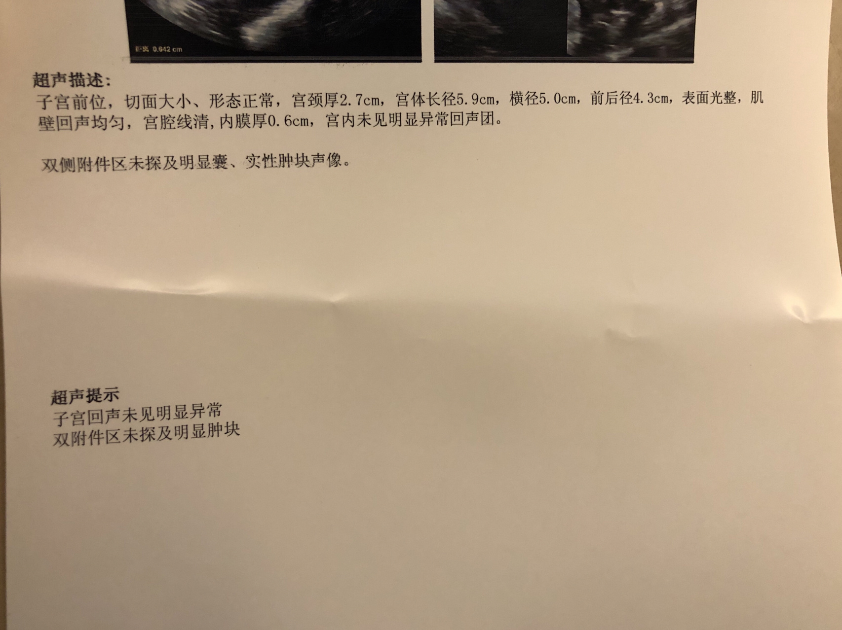 人流后第一次来月经的状况