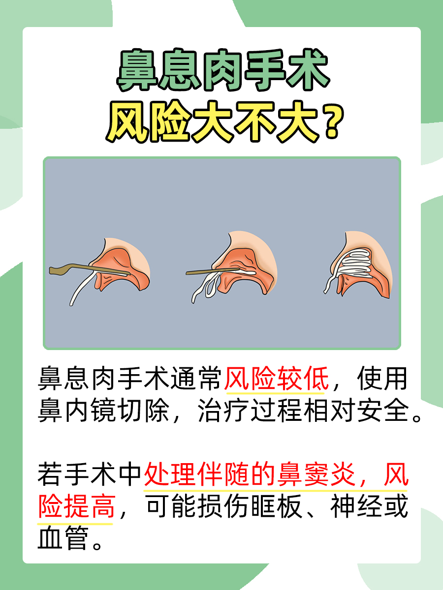 全面了解鼻息肉