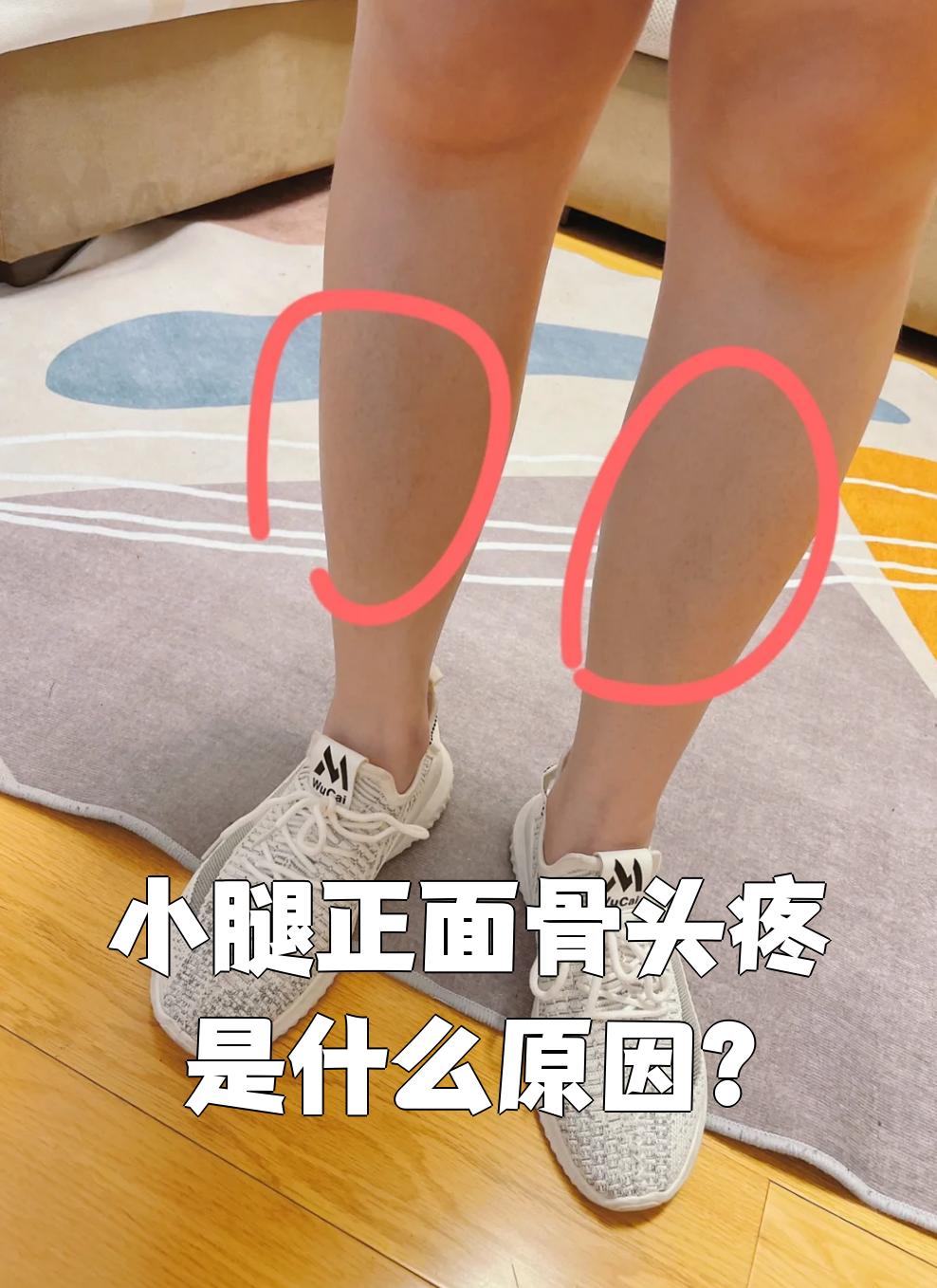 右小腿外侧痛是什么原因