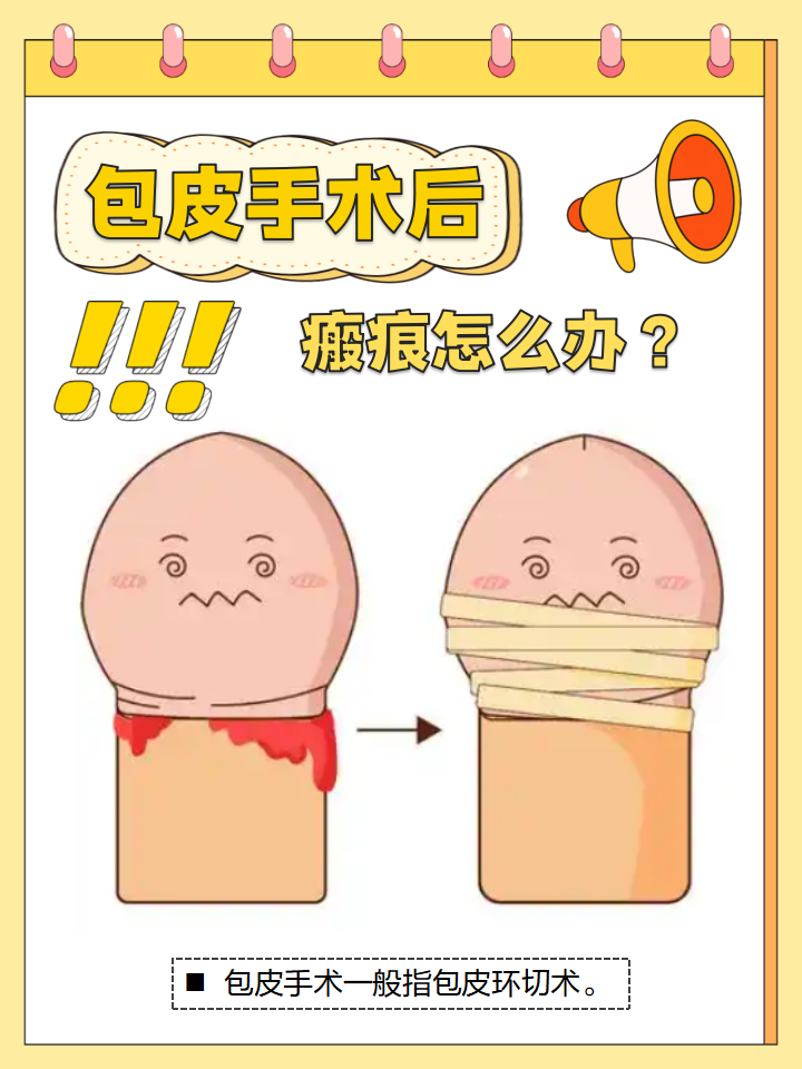 柴夜天