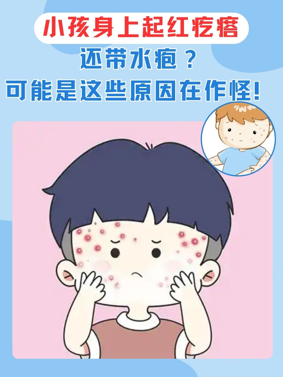 孩子出水痘怎么办