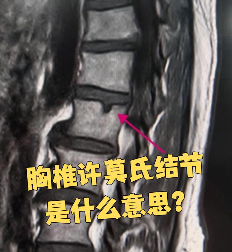 季云岚