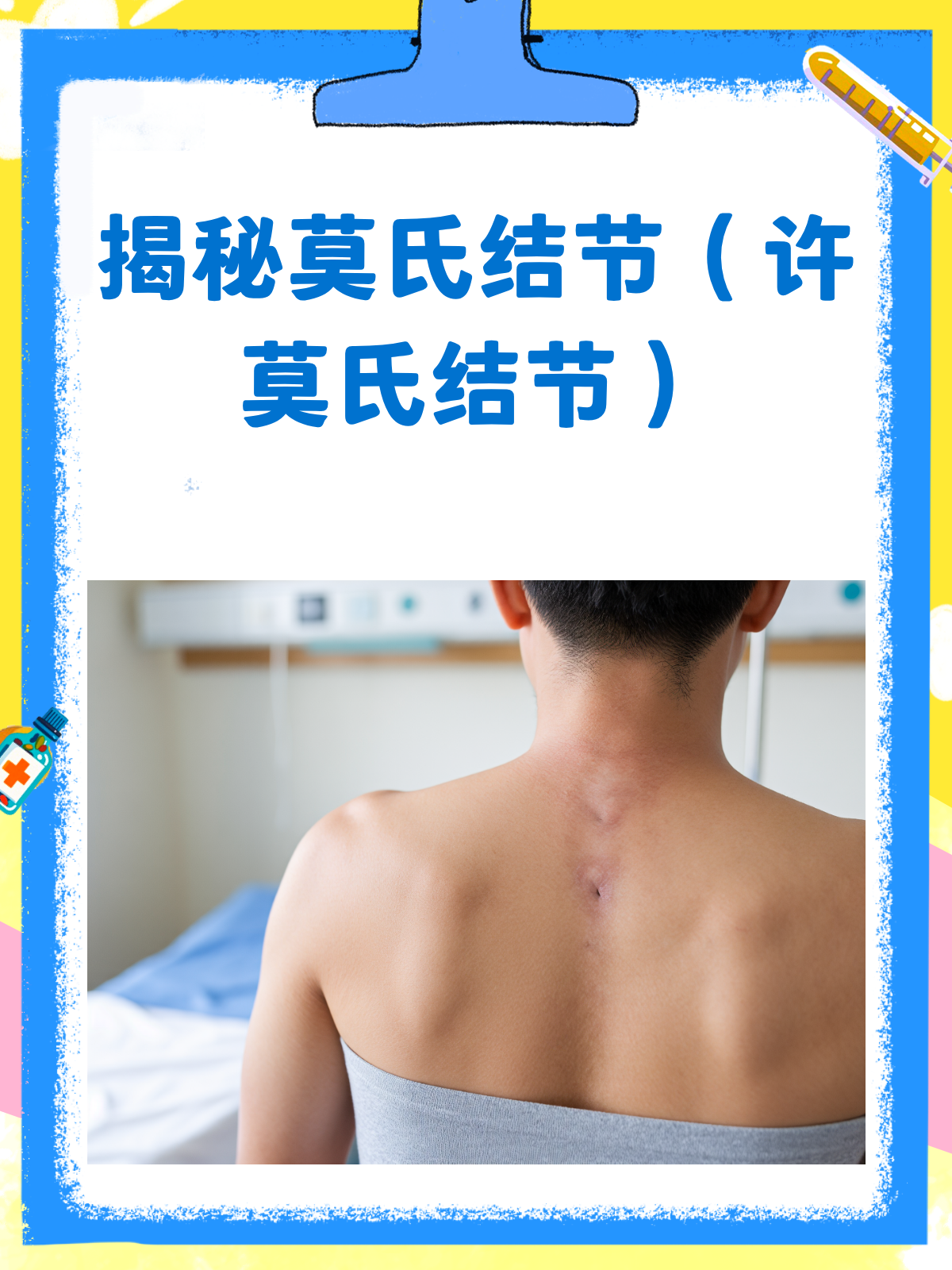 什么是许莫氏结节?..
