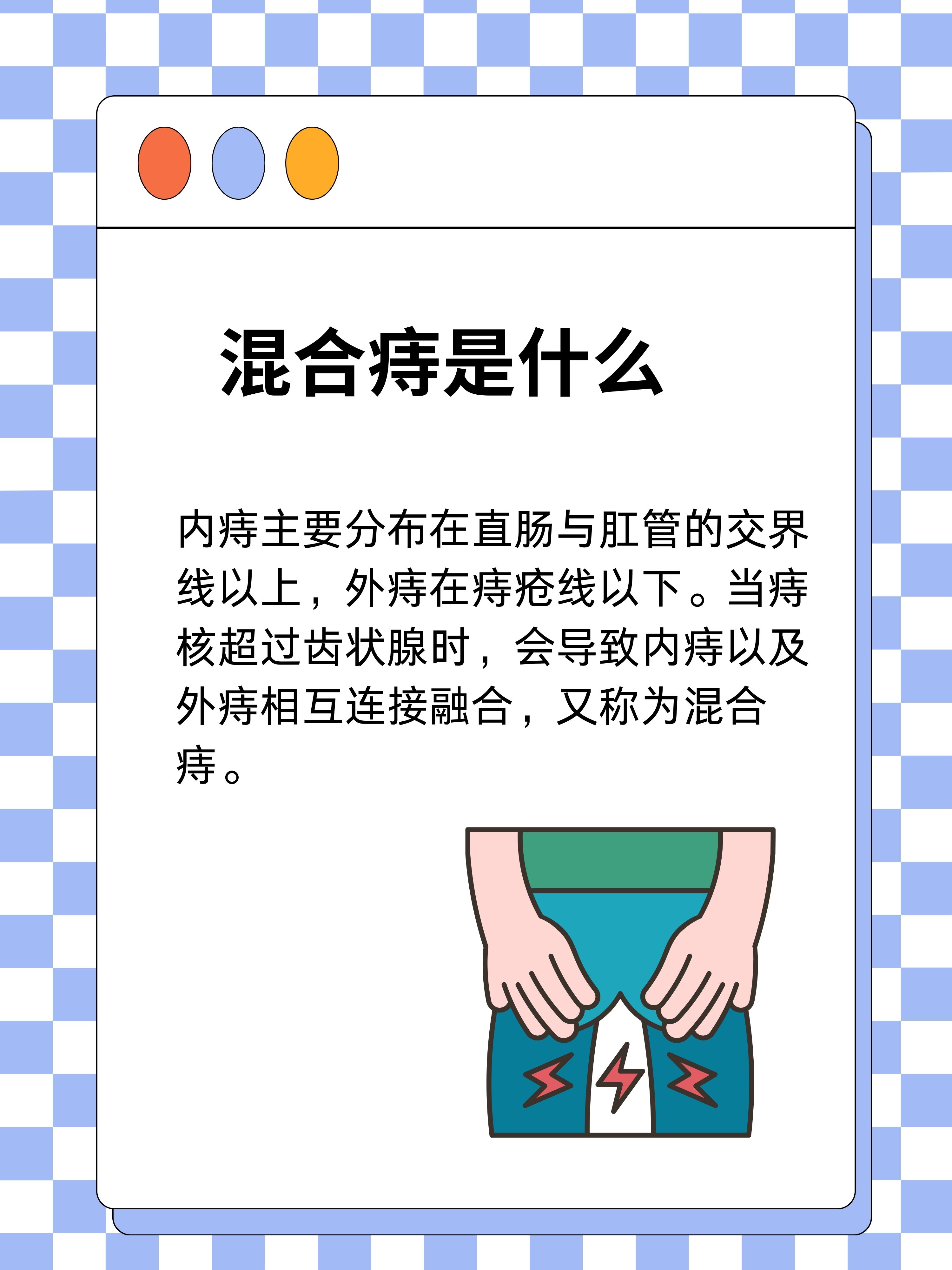 帖尔蝶