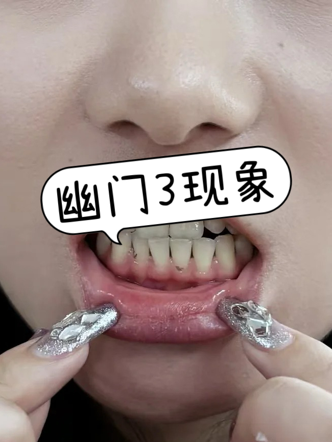 龚姝丽