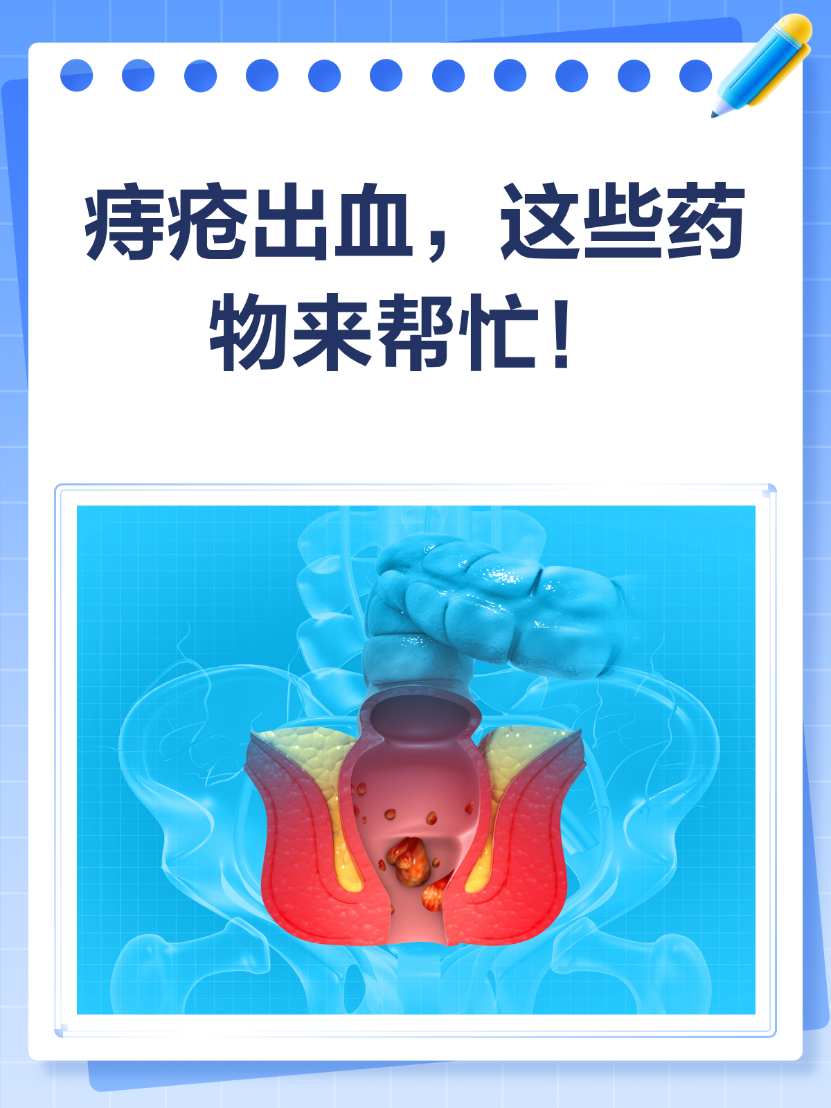 内痔出血怎么办?