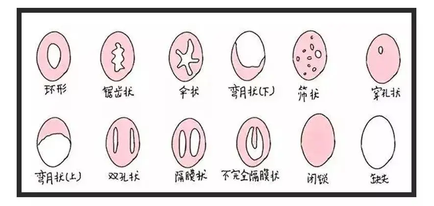 第一次进不去怎么办?