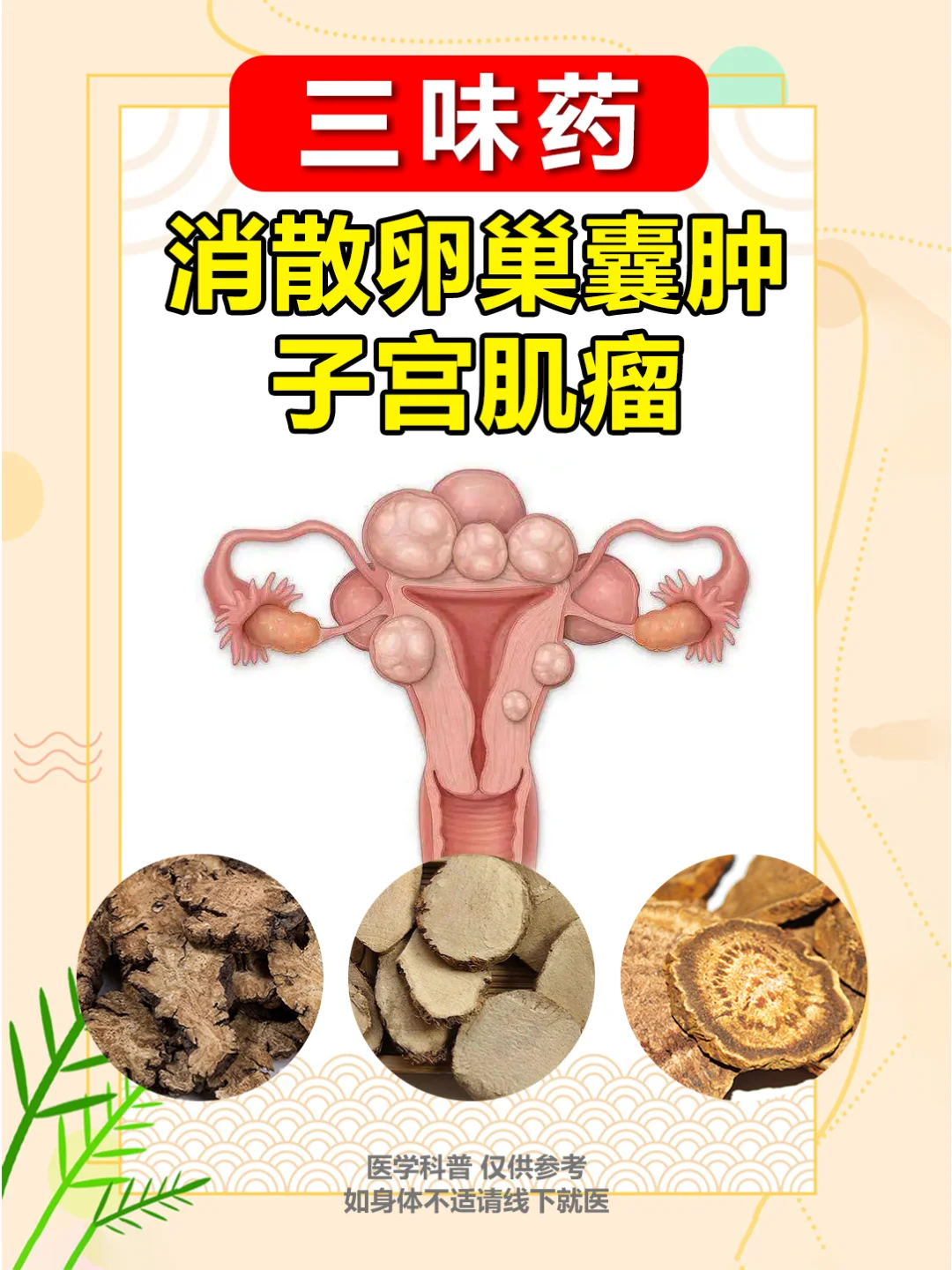 吃什么药能治子宫肌瘤