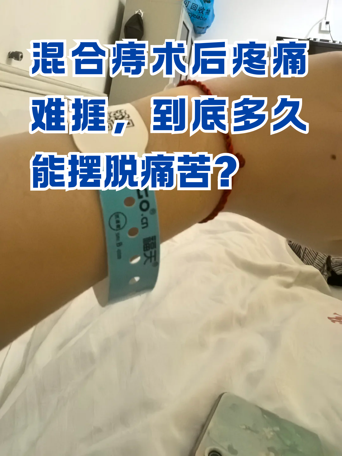 割痔疮要住院吗?要住多久