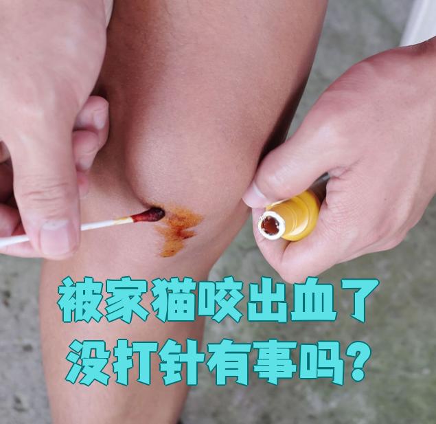 被猫咬到没出血鼓起来了,用打针吗.