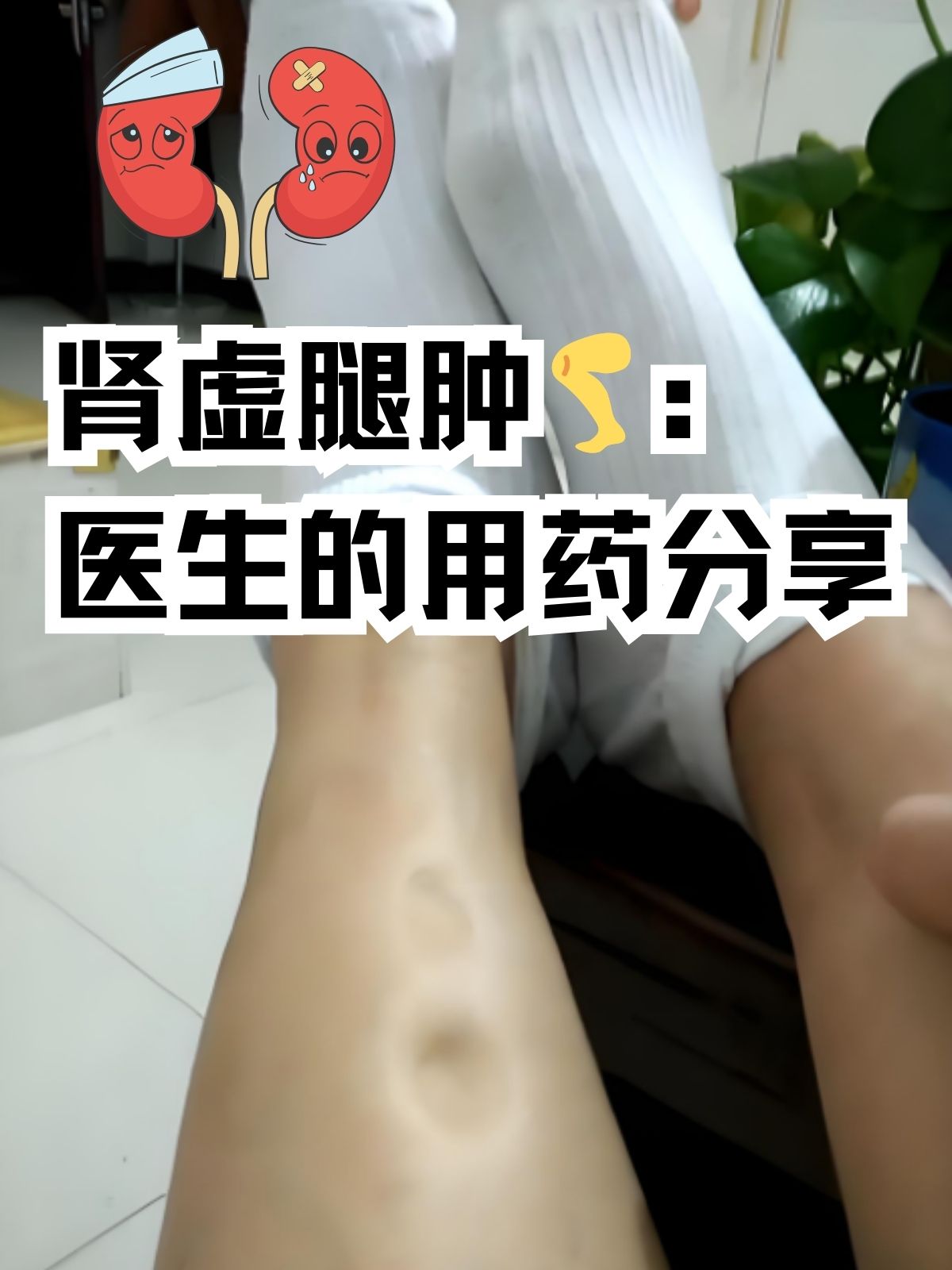 腿肿是什么病的前兆