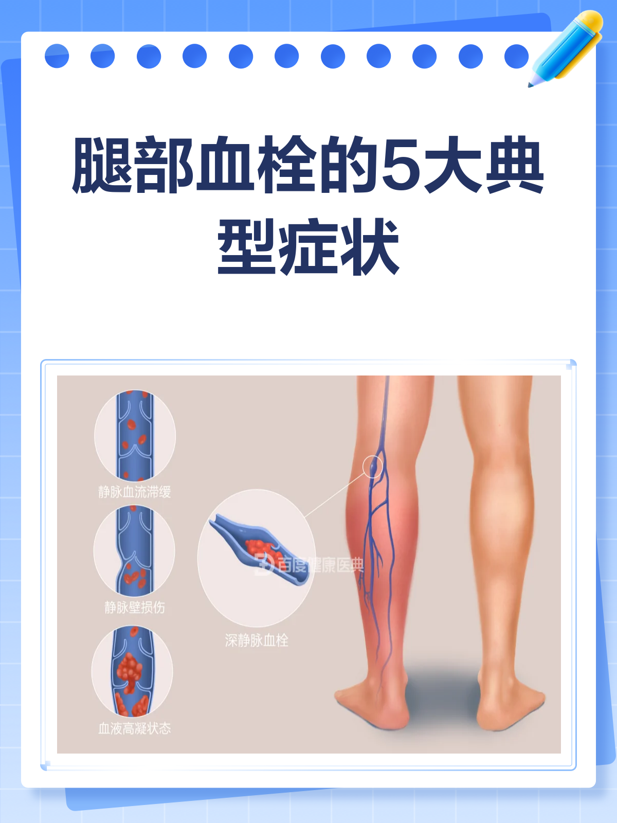 腿部血栓症状