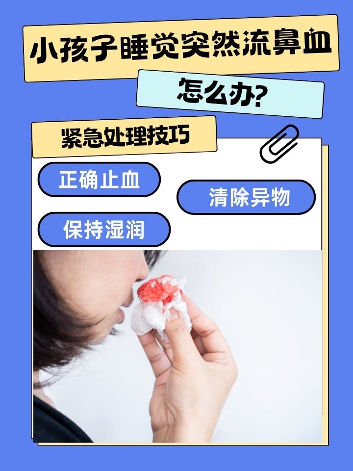流鼻血止不住,怎么办