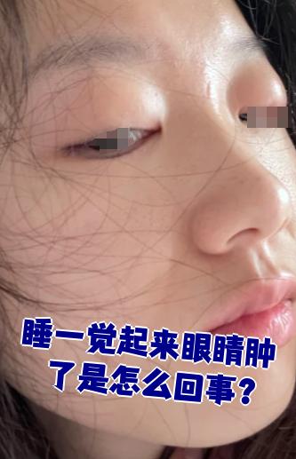 早上起来眼睛肿了,怎么办.
