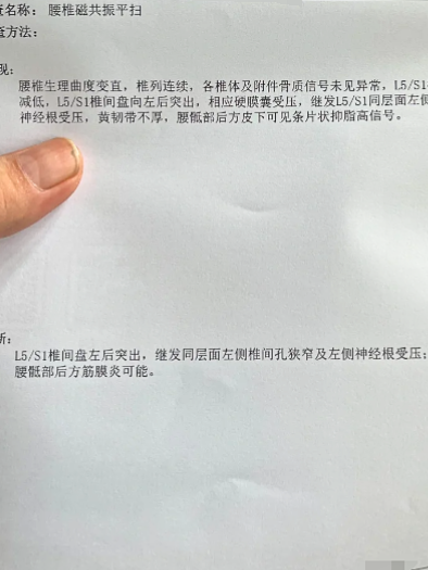 腰椎间盘突出微创风险
