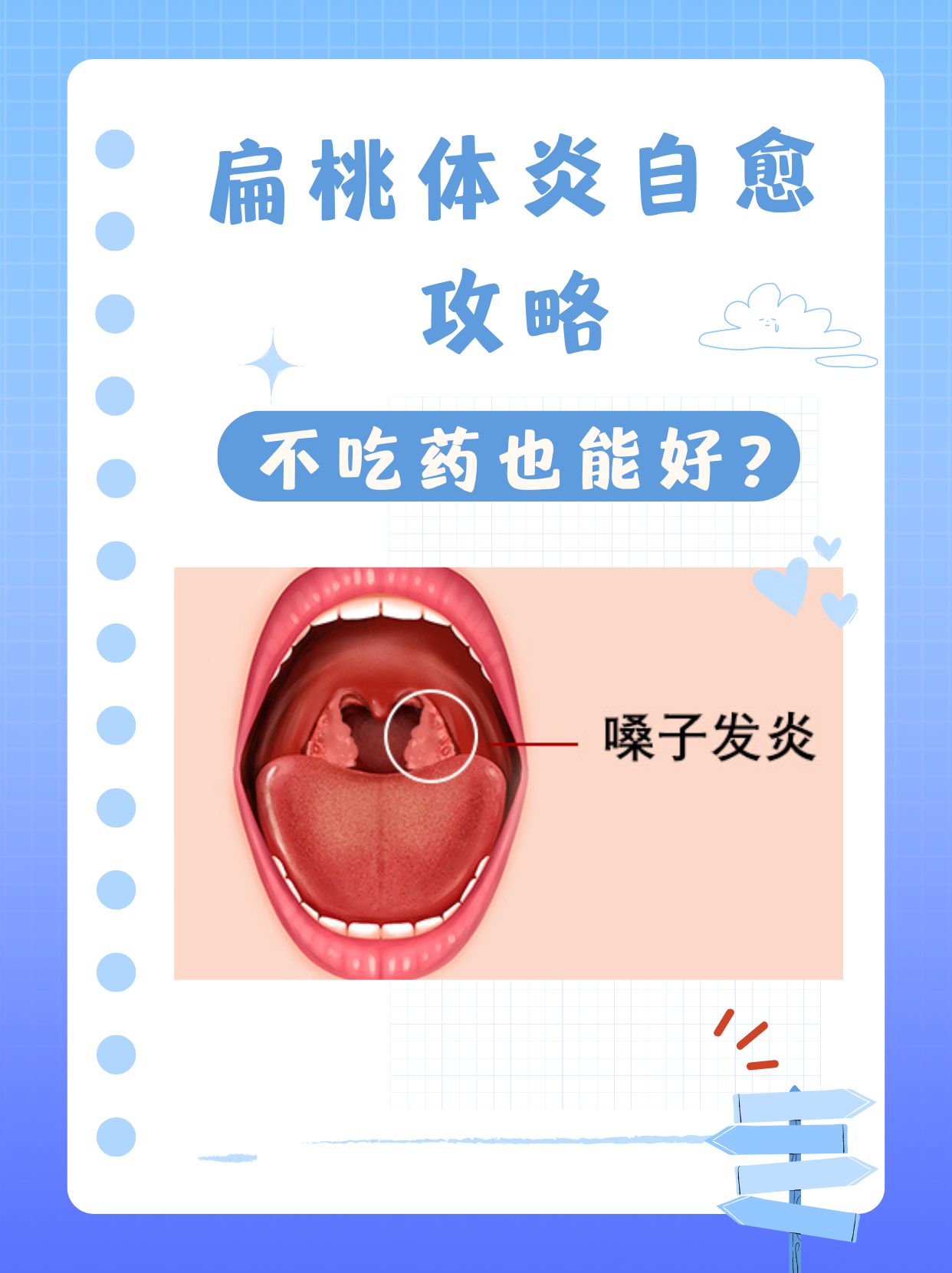 扁桃体炎能吃什么