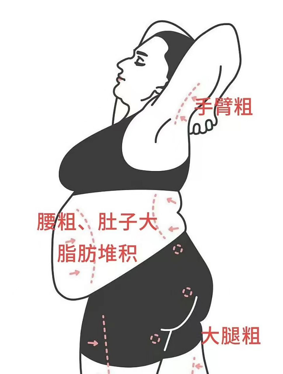 肥胖症的症状有哪些?