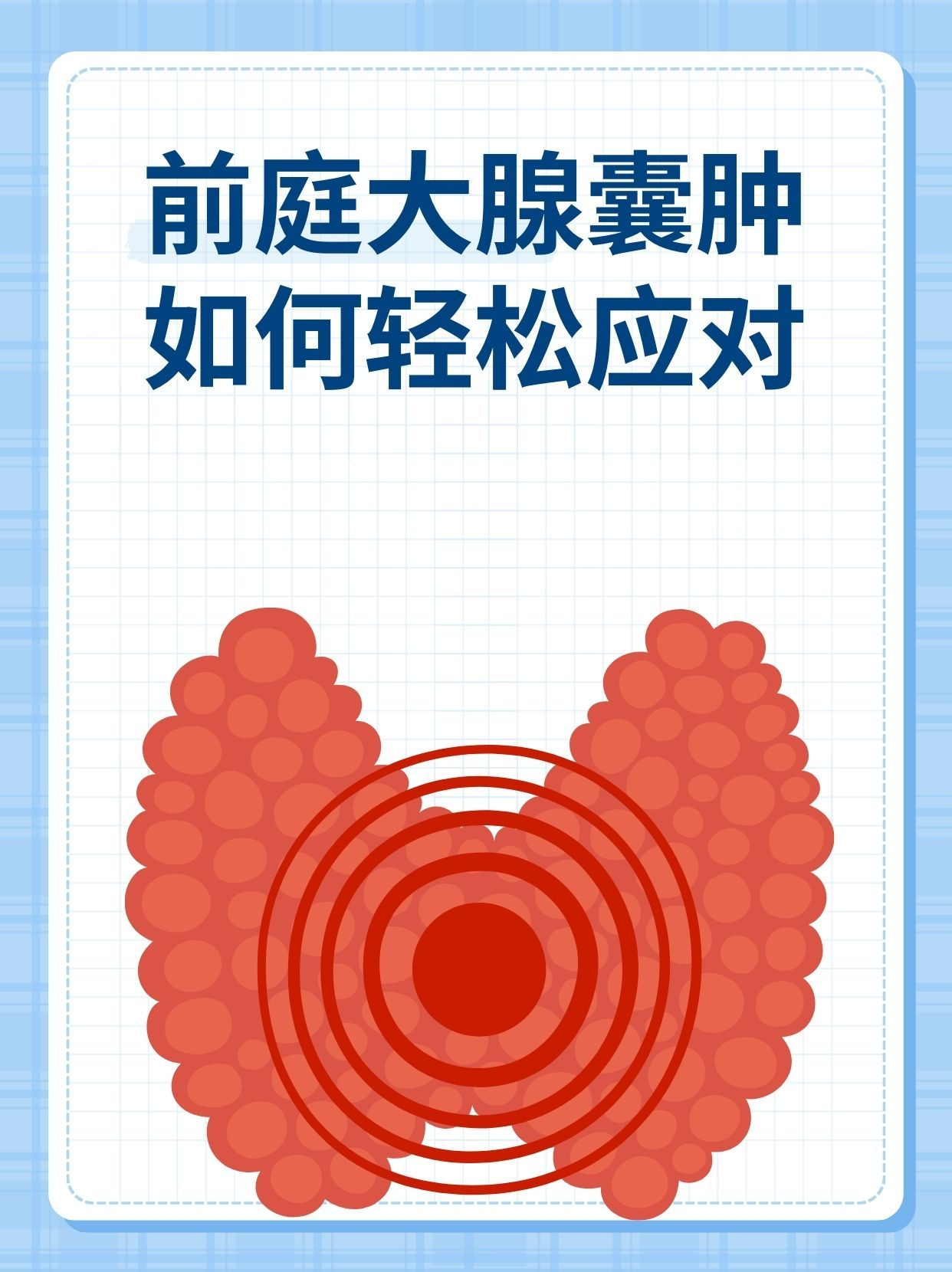 鼻前庭囊肿会自己消吗?