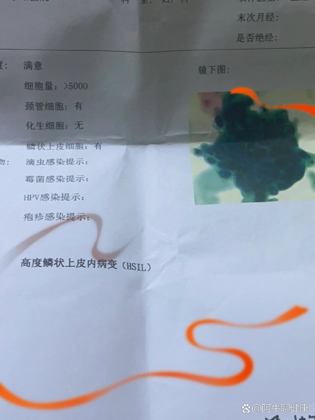 低级别鳞状上皮内病变lsil严重吗