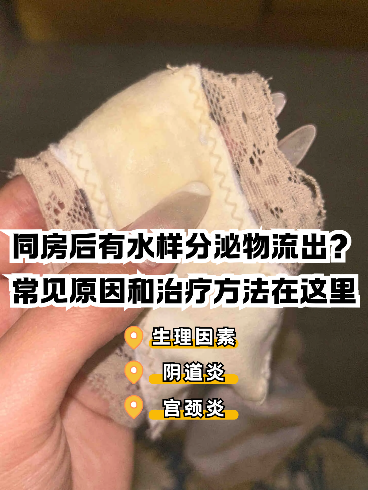 水样白带是怎么回事
