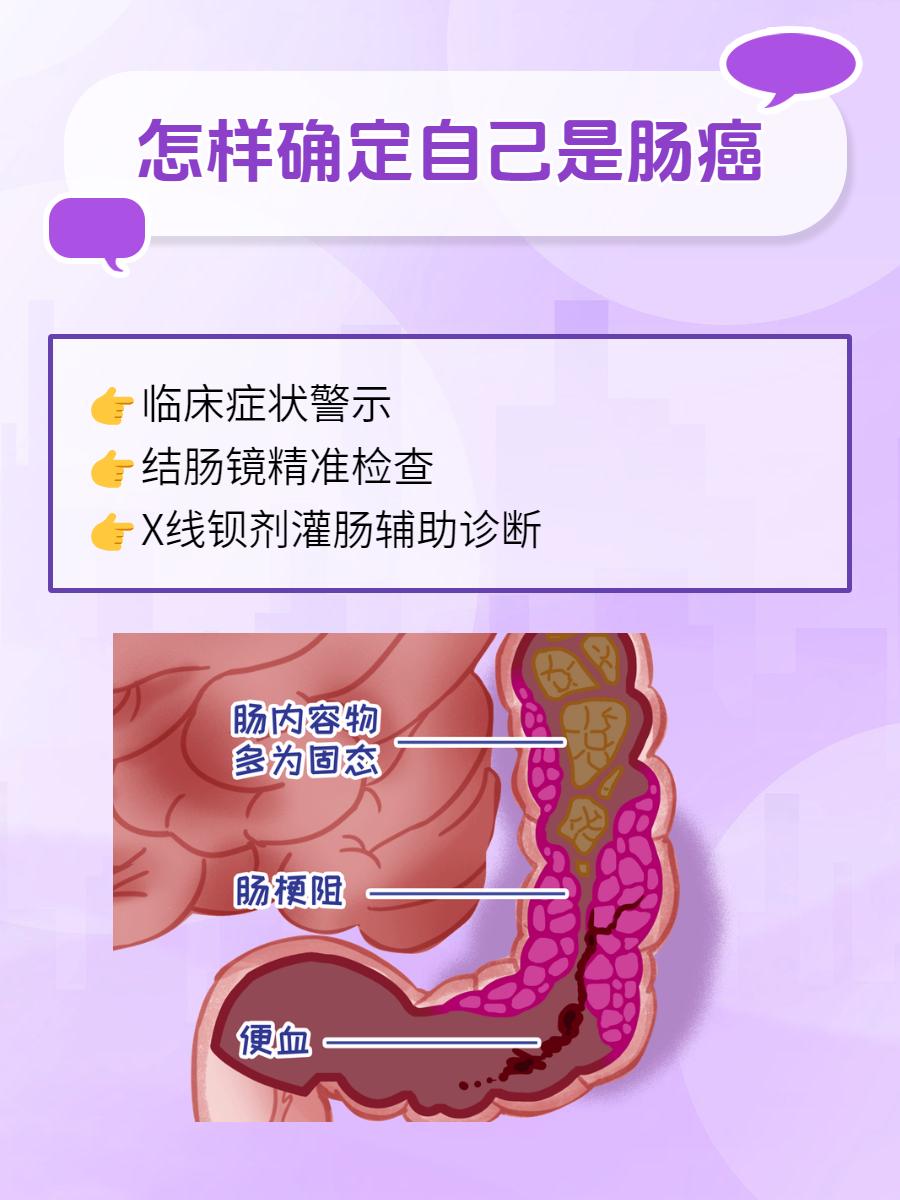 结肠癌什么原因导致的?
