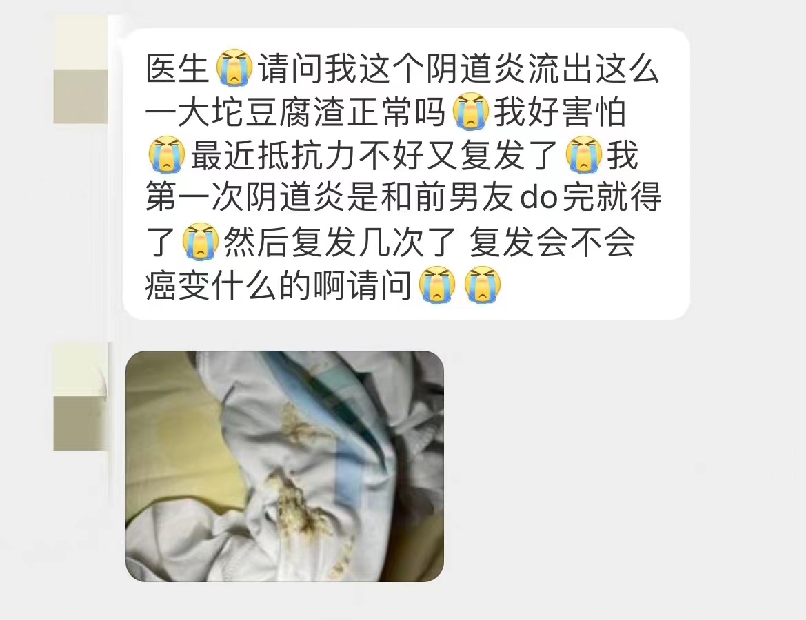 豆腐渣白带能自愈吗