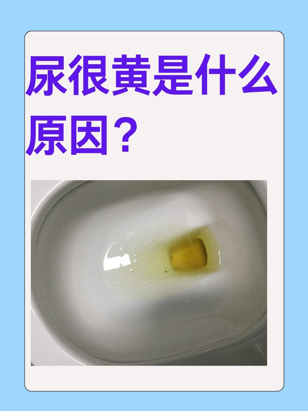 尿液发黄发红是怎么回事?