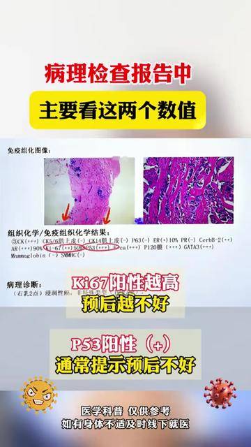 病理检查是什么意思