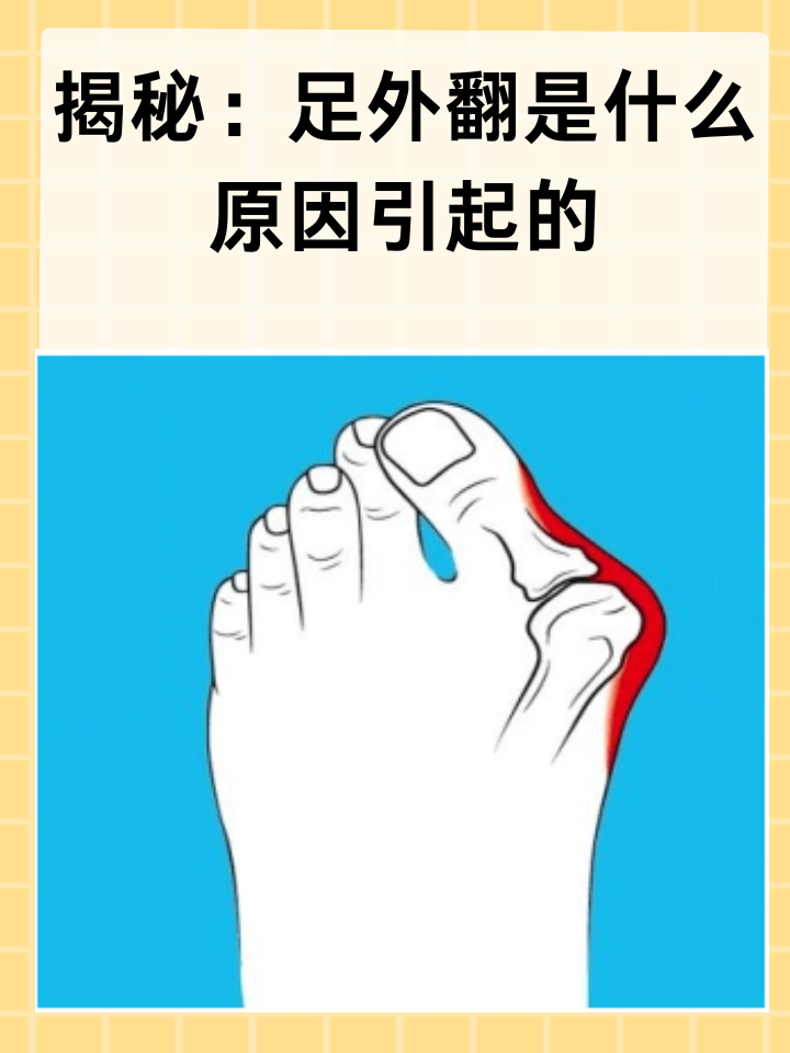 为什么