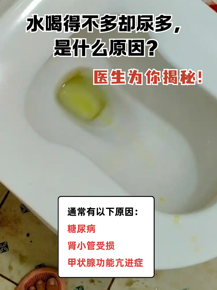 尿液发绿?是怎么回事?