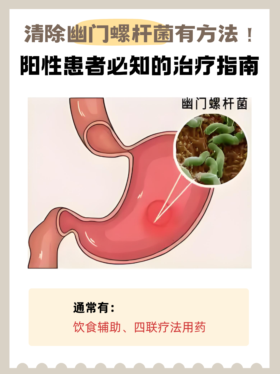 什么是幽门螺旋杆菌阳性?