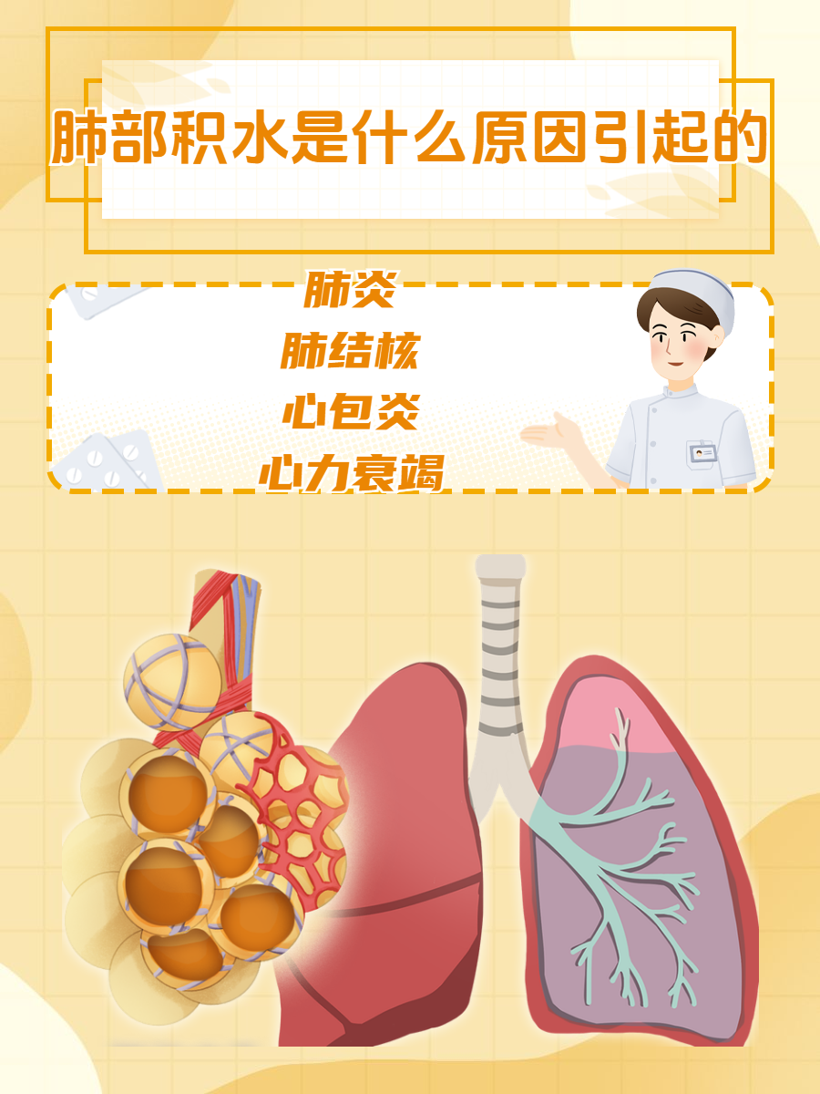 胸腔积水应注意些什么?