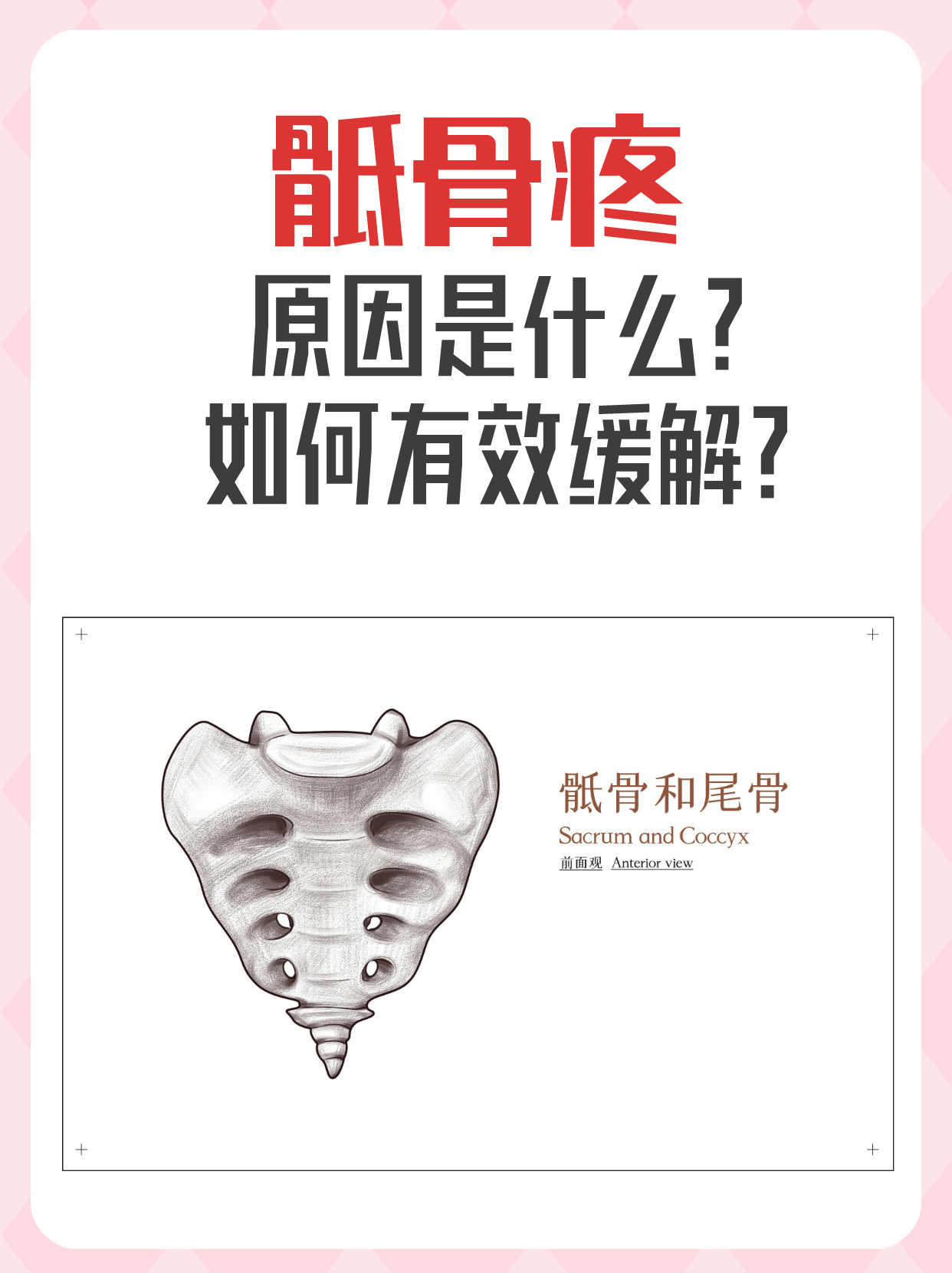 尾骨疼是怎么回事