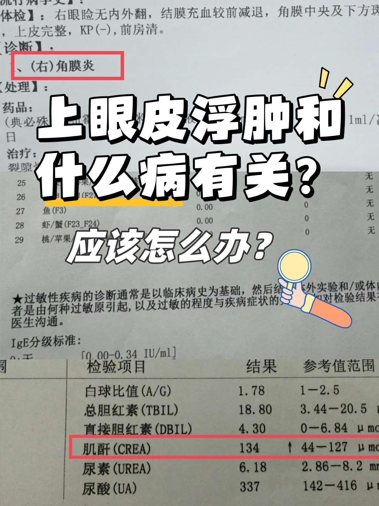 脸部浮肿是什么原因