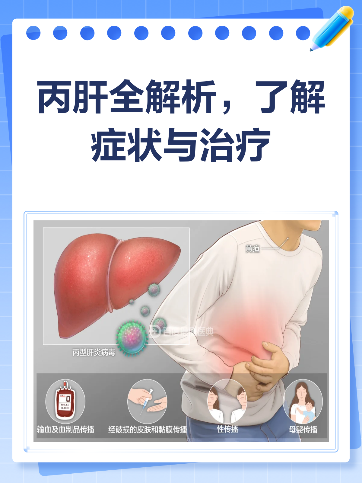 丙肝好治吗