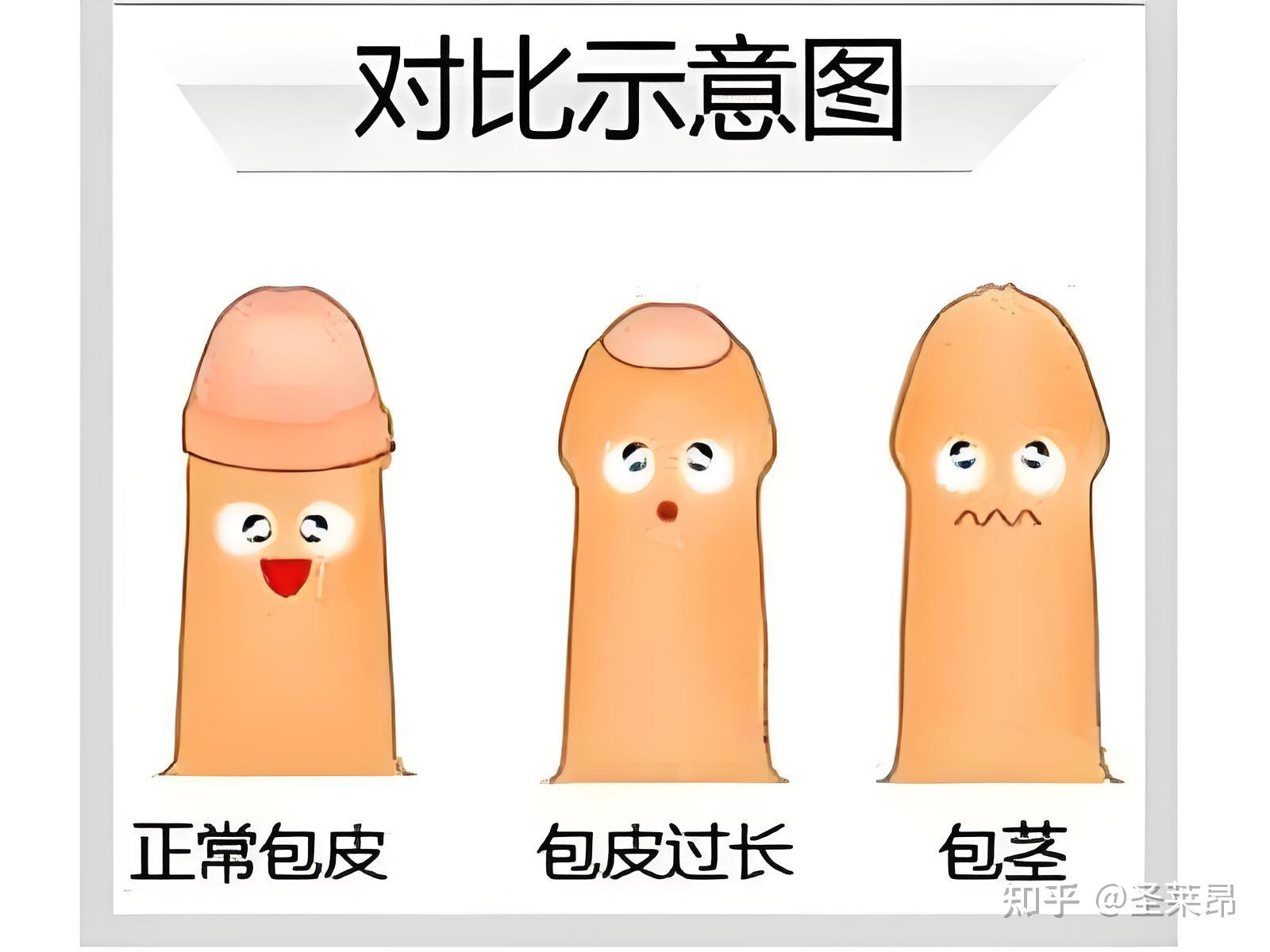 什么是包皮