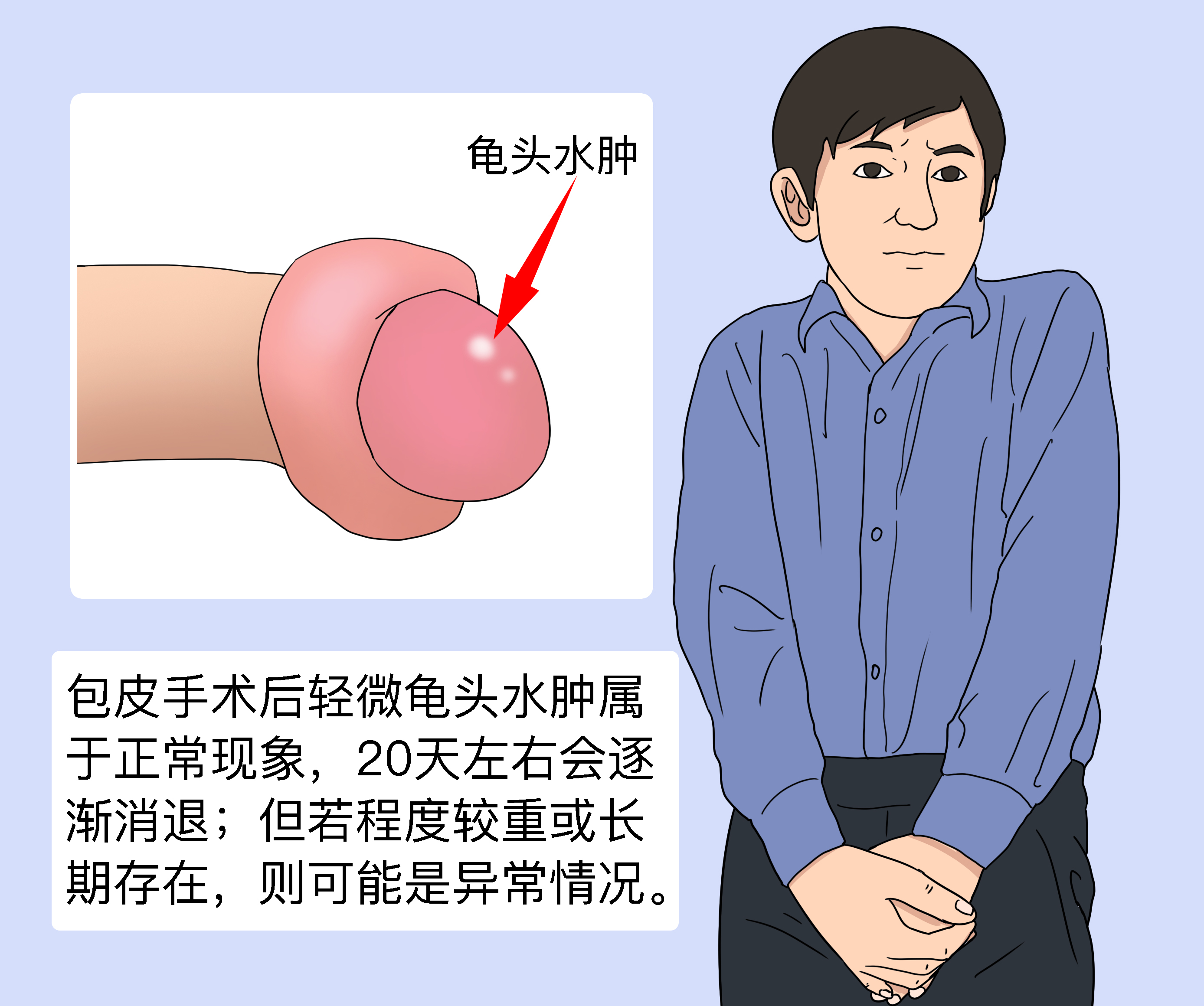 包皮肿了是怎么回事