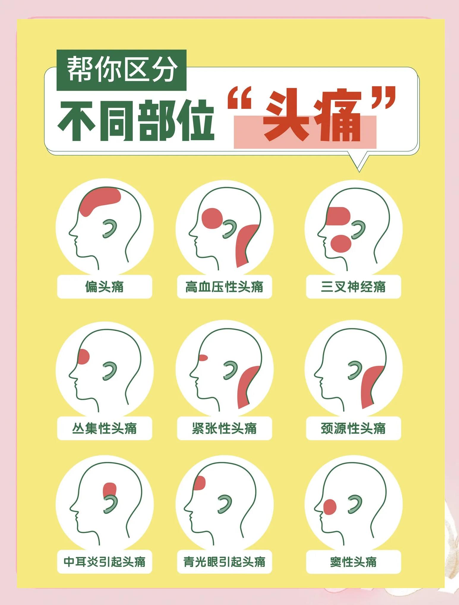 什么原因偏头痛