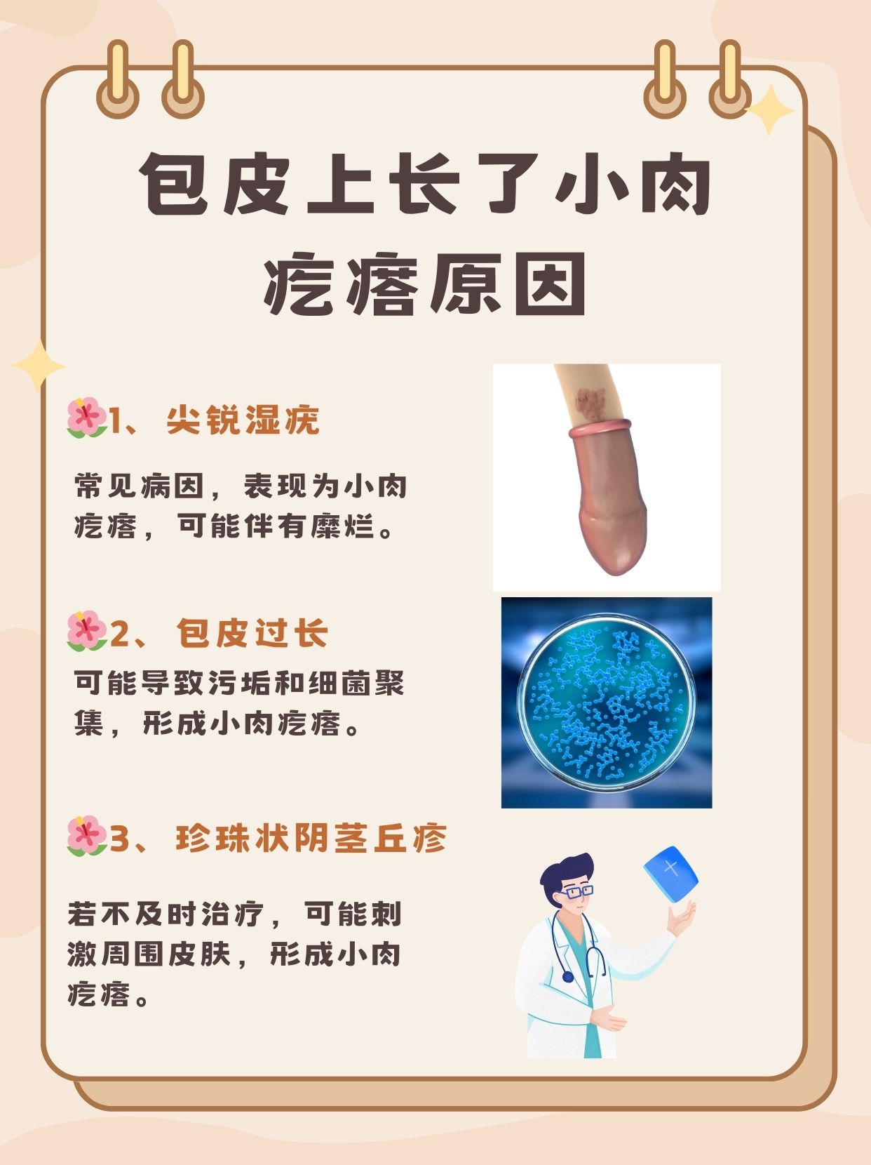 尔余