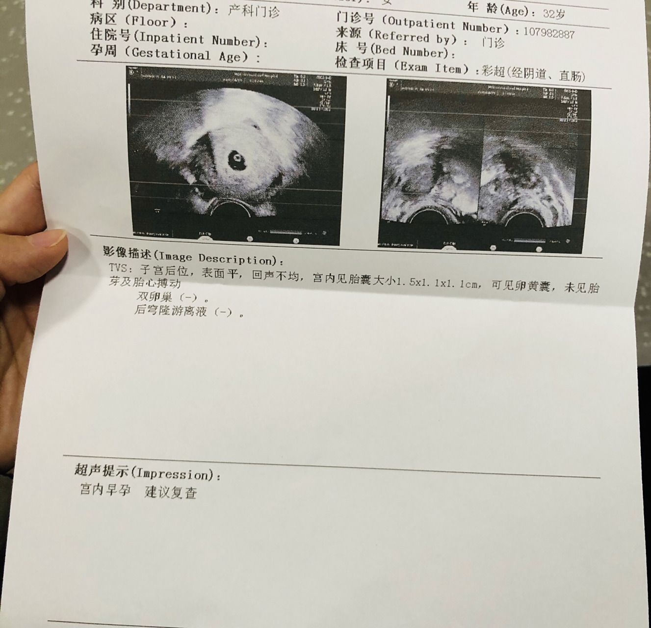 有卵黄囊而没有胎心胎芽正常吗?