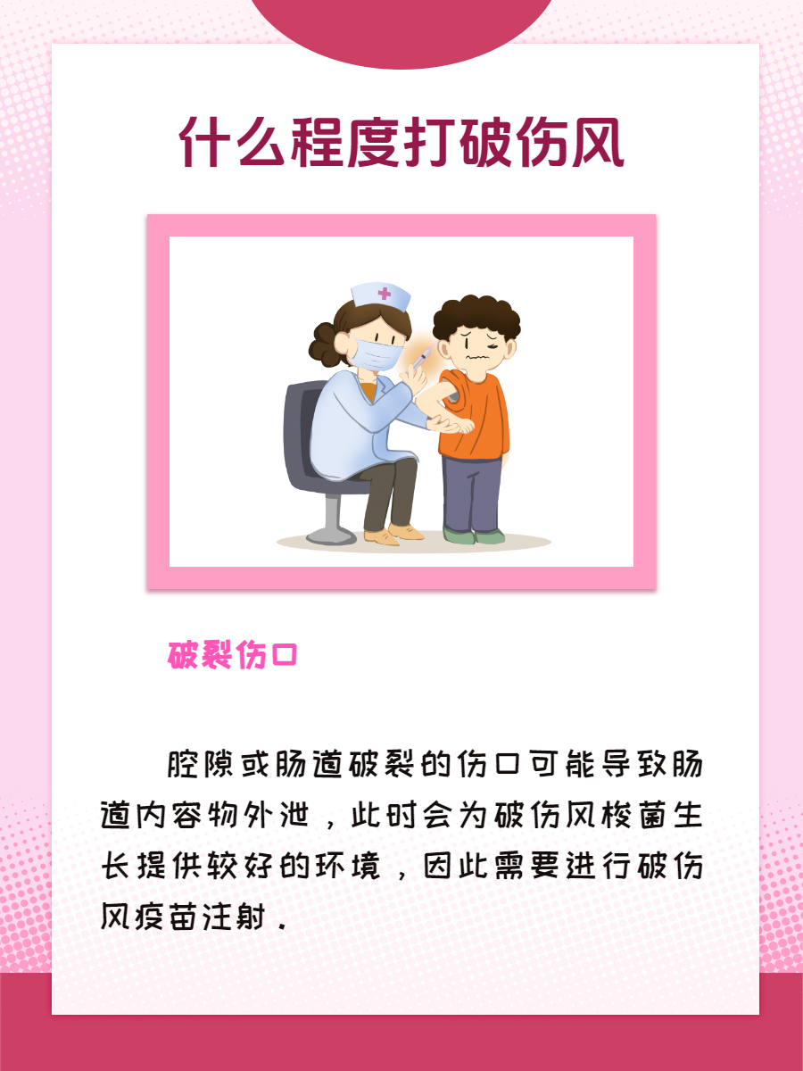 仪良奥