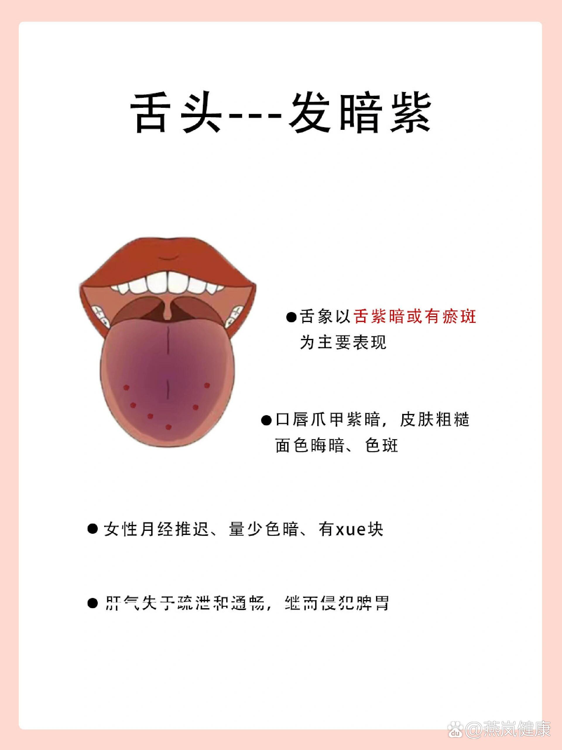舌苔发黑是什么原因