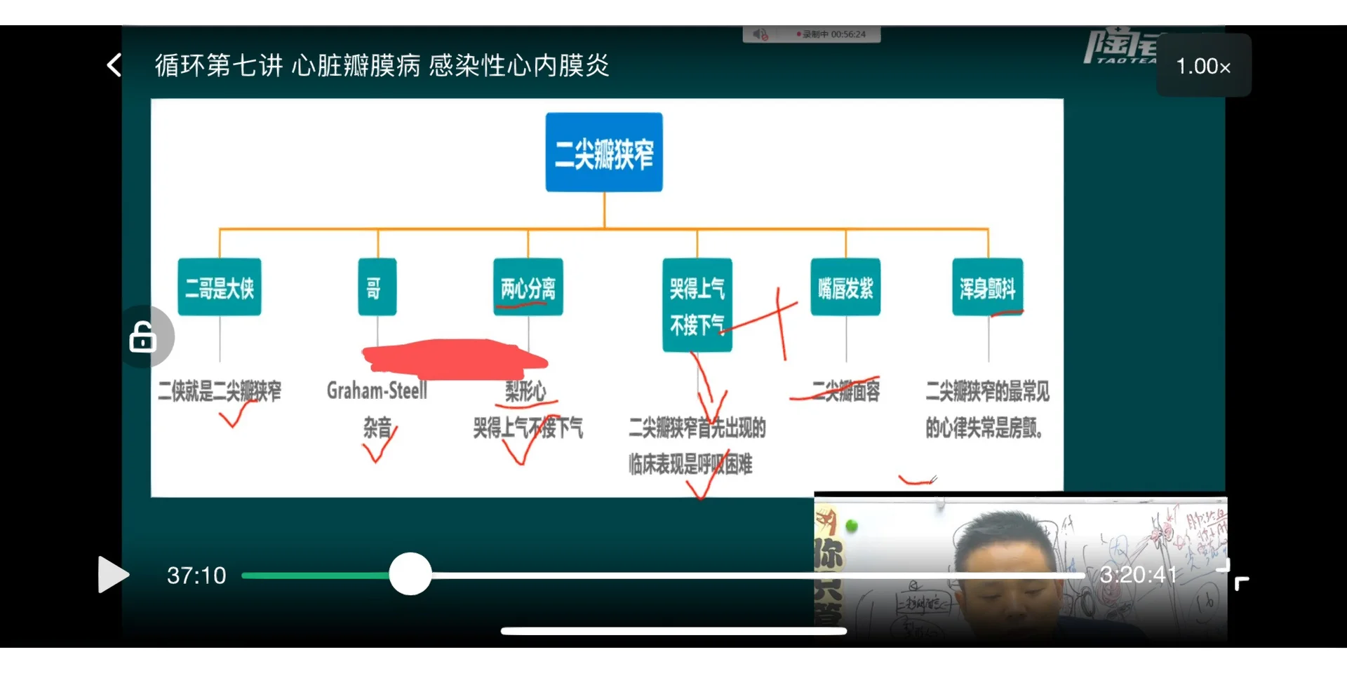 心脏杂音是什么原因引起的