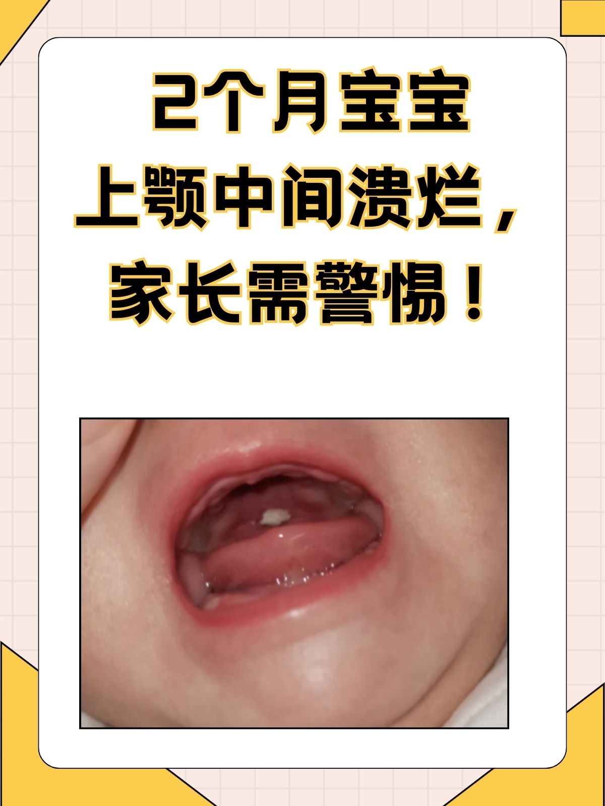 宝宝总是吐奶怎么回事