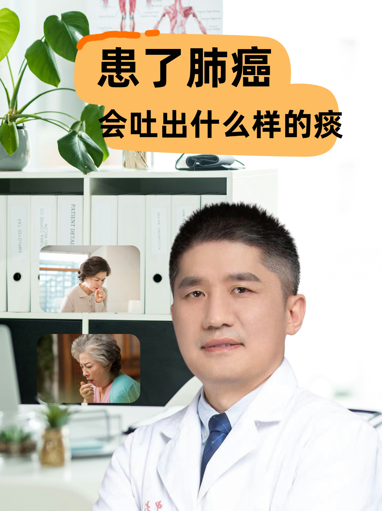 长时间咳嗽会是肺癌吗?