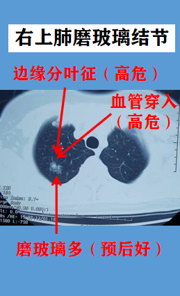 舒安珊