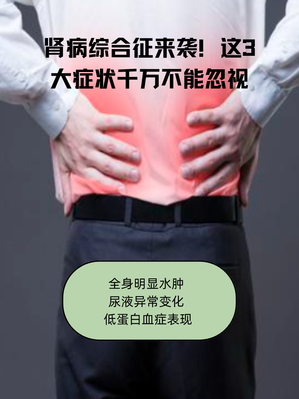 肾病综合征的临床表现