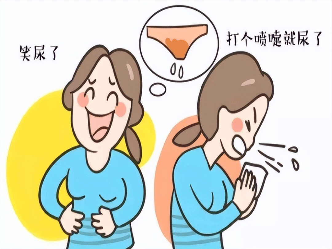 阴道壁膨出是什么症状